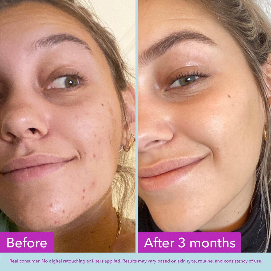 niacinamide-brightening-toner-l2 zb_p.jpg