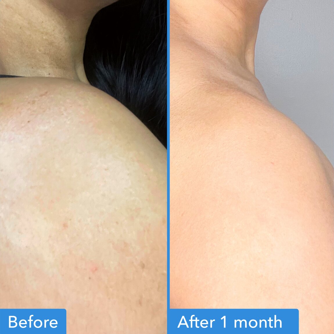discoloration-correcting-body-treatment-o8 zb_p.jpg
