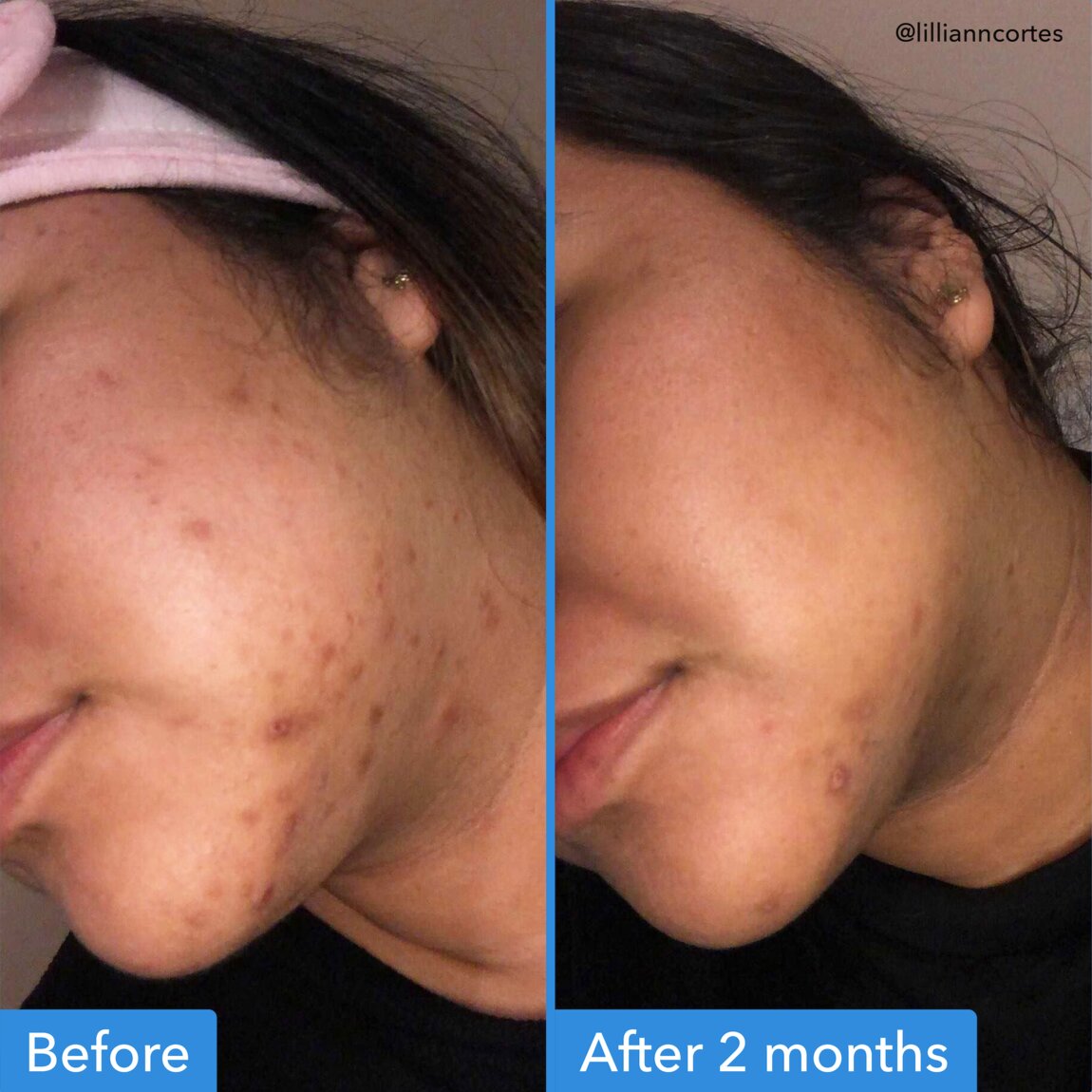 discoloration-correcting-serum-r9 zb_p.jpg